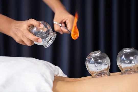 Fire Cupping Therapy in Dewsbury & Batley