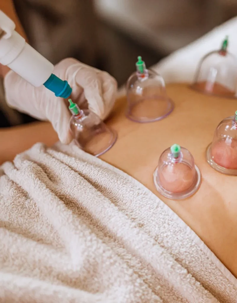 Hijama cupping helps with chronic pain, muscle tension, and fatigue.